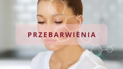 Skóra z melazmą i przebarwieniami pozapalnymi (Comming Soon)